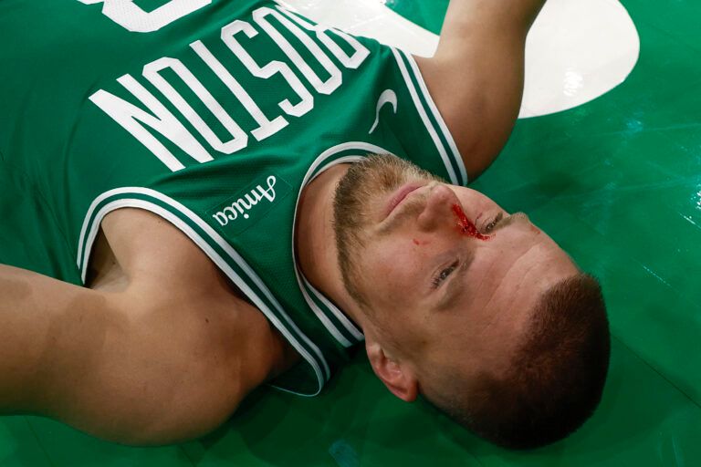 Apr 4, 2025; Boston, Massachusetts, USA; Boston Celtics center Kristaps Porzingis (8) lies on the floor after being cut by an elbow to the nose by Phoenix Suns forward Cody Martin (17) during the second half at TD Garden. Mandatory Credit: Winslow Townson-Imagn Images