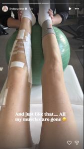 Vonn shares post-injury update